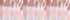 White Burst Tie Dye